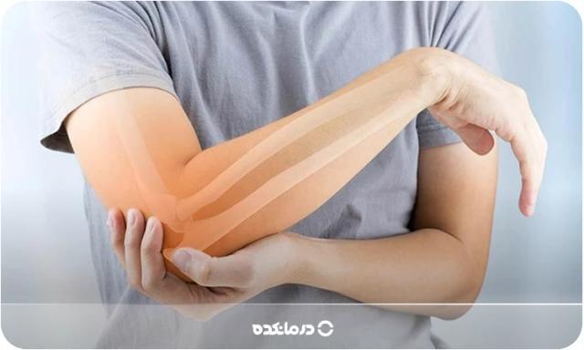 علت استخوان درد در زنان چیست؟ ۱۰ علل رایج + راهکار درمان