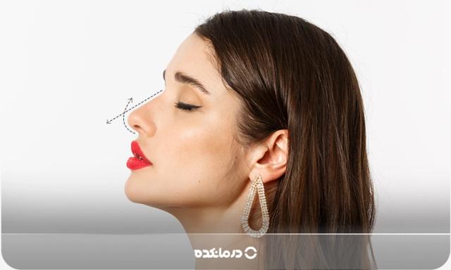 راهنمای انواع فرم بینی طبیعی و عملی مردانه و زنانه + عکس