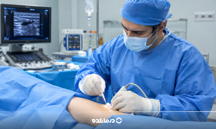 عمل واریس پا چگونه انجام می‌شود؟ بررسی انواع جراحی، عوارض و دوره نقاهت